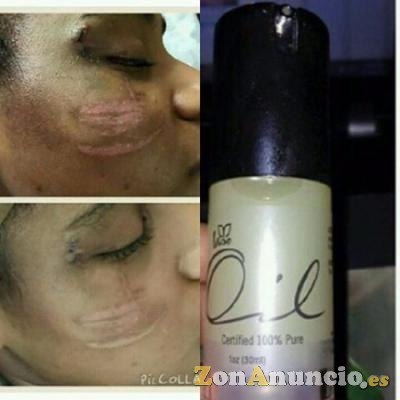 Iaso oil para el cuerpo