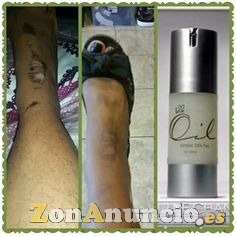 Iaso oil para el cuerpo