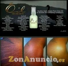 Iaso oil para el cuerpo