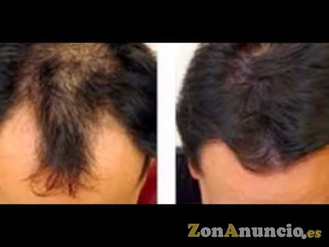 Iaso oil para el cuerpo