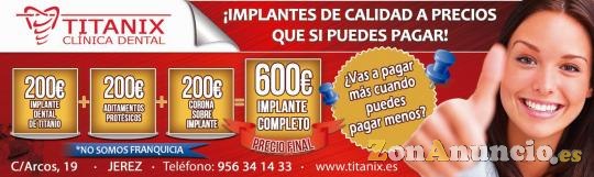 IMPLANTES DENTALES BARATOS EN JEREZ