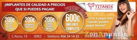 CLINICA DENTAL EN JEREZ OFERTA 200€ EL IMPLANTE DENTAL