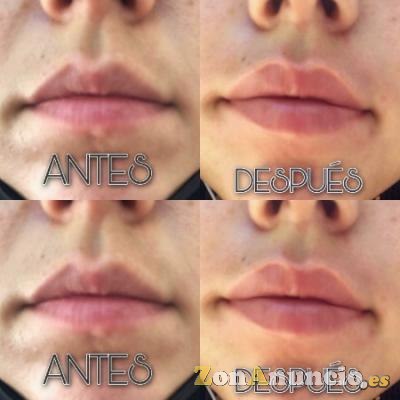 belleza y bronceado